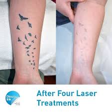 We did not find results for: Sydney Laser Tattoo Removal We Last Saw This Flock Of Seagulls In May Since