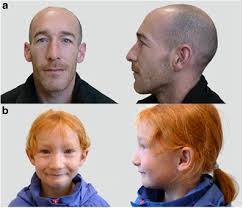 Image result for Dignathia