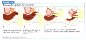 Favorable outcome seemed to correlate with lack of pulmonary involvement, surgical debridement, neutrophil recovery, and a cumulative total amphotericin b dose of. Health Reference Center Academic Document Digital Rectal Examination