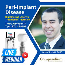 repost #digitalimplantology #implantdentistry #implantcrown…