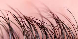 Excessive hair growth can either be hypertrichosis or hirsutism. 8 Things Your Body Hair Says About Your Health Per Doctors