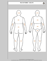 Rules Of Nines Chart Burns Degree Chart Chemical
