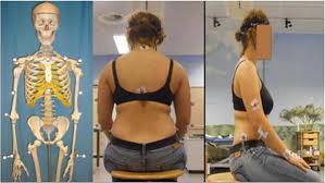 Skeletal model with markers and test person sitting