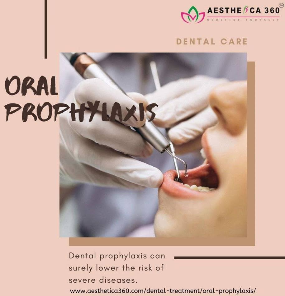 Dental Cleaning & Polishing product image