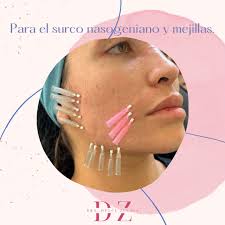 Hilos revitalizantes de PDO Tratamiento para estimular la producción de  colágeno y elastina ✨ . #pdothreads #hilospdo #bioestimuladores