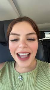 Valió la pena ? Quedar pel🧑🏻‍🦲✨💕