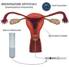 Clicca sul pulsante viola consulta il catalogo dei donatori di seme. Inseminazione Artificiale