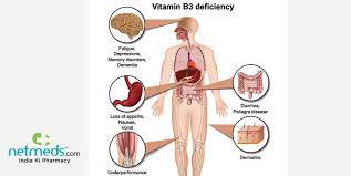 Pellagra: Causes, Symptoms And Treatment Of This Vitamin B3 Deficiency  Syndrome