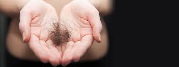 If a child who suffers from hair loss doesn't have an alopecia condition, most likely that child has lost his hair as a result of cancer treatments. Myths About Women S Hair Loss Rogaine Canada