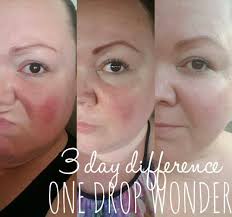 Rosacea One Drop Wonder By Limelight By Alcone Best Product For Skin Issues Skin Care Pimples Rosacea Skin Care Rosacea