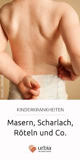 Kinderkrankheiten Masern Scharlach Roteln Und Co Kinderkrankheiten Krankheit Ausschlag Kinder