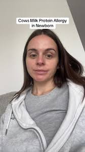 Understanding Cows Milk Protein Allergy in Babies