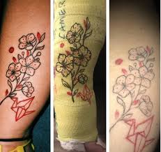 It's believed that the laser is the safest and most painless way to remove an annoying tattoo. 35 Eye Opening Photos That Show How Tattoos Age Over Time