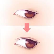 Vista eye specialist is recommended by their patients for their good doctors, professional service, professional staff, and friendly environment. 24 Best Double Eyelid Surgery In Kuala Lumpur Price Guide Reviews