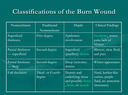 Burns