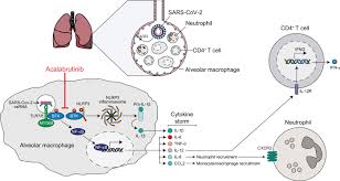 Inhibition of Bruton tyrosine kinase in patients with severe COVID-19 |  Science Immunology