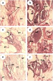 Image result for Anthonotha macrophylla