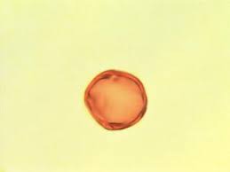 Image result for Manilkara obovata