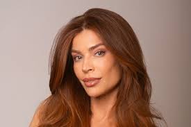 Marca escolhe modelo albina para campanha de beleza