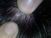 Was Zum Kuckuck Ist Das Fur Ein Knubbel Auf Dem Kopf Urbia De