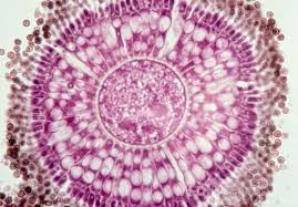 Aspergillus are found in millions in pillows. Aspergillus Niger Fruiting Head Histology Picture Medtube Net