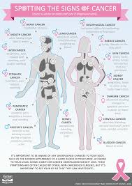 I went ahead and did the liver biopsy, and it confirmed the same adenocarcinoma. What Are The Early Symptoms Of Bladder Cancer