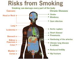 Can Popcorn Lung Lead To Cancer