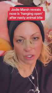 Jodie Marsh Gets Bitten by Animal at Sanctuary