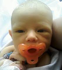 Baby Braxton needs a hand: Fundraiser set for Rochester infant born with  Biliary Atresia Splenic Malformation