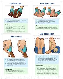 Image result for Galeazzi Sign