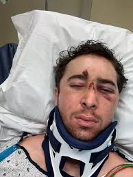 Man who made miracle recovery after freak accident hailed 'real-life Rocky'  by Sylvester Stallone