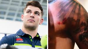 Listen to curtis scott | soundcloud is an audio platform that lets you listen to what you love and share the sounds you create. Nrl 2020 Curtis Scott Tasered Images Of Bruises Arrested Legal Action Herald Sun