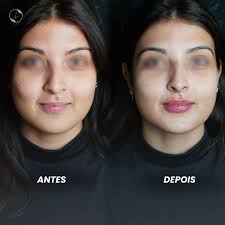 Tom Freittàs (@clinicatomfreitas) • Instagram photos and videos