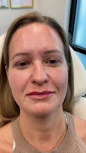 Idahormones & Meridian Medical Aesthetics (@meridianmedicalaesthetics) •  Instagram photos and videos