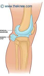 Pin On Knee Pain