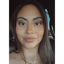 Any estheticians around here that do microneedling ?