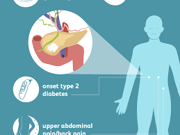 The earlier it is detected, the easier it is to treat and the greater the survival rate. Pancreatic Cancer Signs Symptoms And Complications
