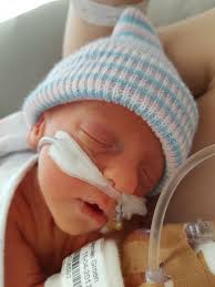 Moeder Van Jaymee Jaymee Is Met 32 Weken En 4 Dagen Geboren Bijna 2 Maanden Te Vroeg Uitgerekende Datum Was 2 Juni Gelukkig Ademt Ze Vanaf Het B Baby Kind