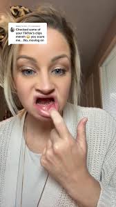 Understanding Dentures: Tips and Personal Experiences