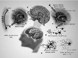 Illustration Of Parkinson S Disease Gene Therapy Strategies To Date A Download Scientific Diagram