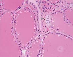In humans, the ultimobranchial body is an embryological structure that gives rise to the parafollicular cells of the thyroid gland. Parafollicular Cell Anatomy Britannica