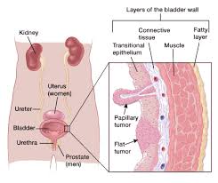 Tumors can also develop in the prostate gland in male dogs. If You Have Bladder Cancer