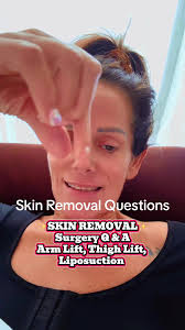 What Surgery Did Tonya Have