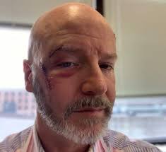 David Croft: Bad Bald Jokes Just Slide Right Off