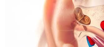 Tinnitus involves perceiving sound when no external noise is present. Tinnitus Allgemeine Informationen Igel Apotheke