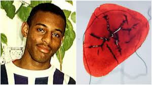 Stephen Lawrence: How a tiny speck of blood cracked racist murder case in  Eltham