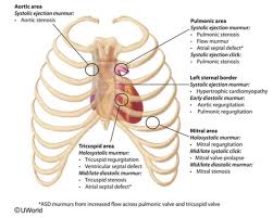 Image result for Point of Maximum Impulse
