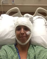 JoAnne Michael doesn't remember much about 2018. That year, at the age of  45, she began having cognitive issues, including memory loss, confusion,  and brain seizures. Her symptoms were caused by a