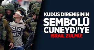 İsrail askerinin kolu sargılı olan filistinli bir çocuğu gözaltına almak istemesiyle arbede çıktı. Kudus Direnisinin Sembolu Cuneydi Ye Israil Zulmu