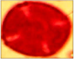 Image result for Morinda lucida